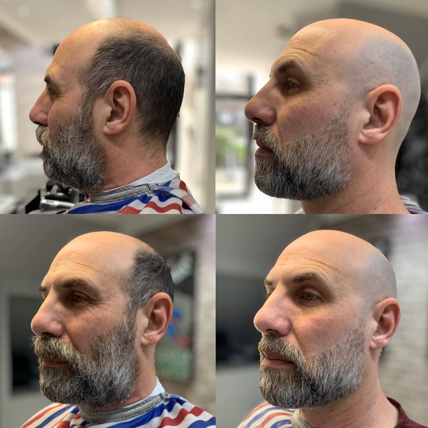 Precision Skin Fade Cut